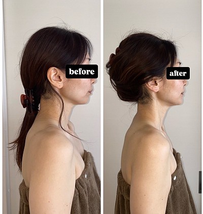 背中美人に 肩こり改善 頭痛解消